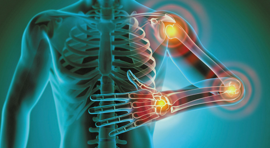 illustration de l'inflammation chronique
