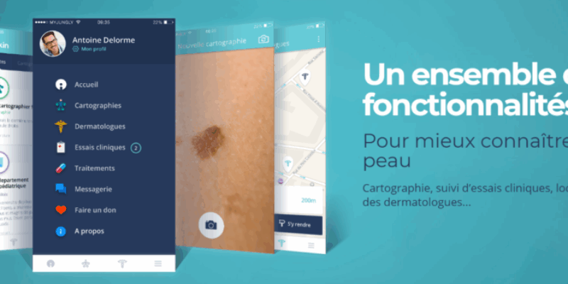 iSkin Détection Mélanome : Révolution IA pour Diagnostic Précoce Cancer ...